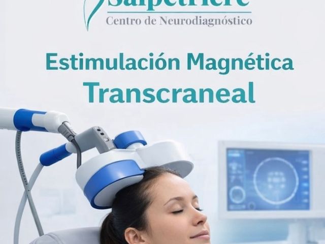 estimulacion magnetica trascraneal