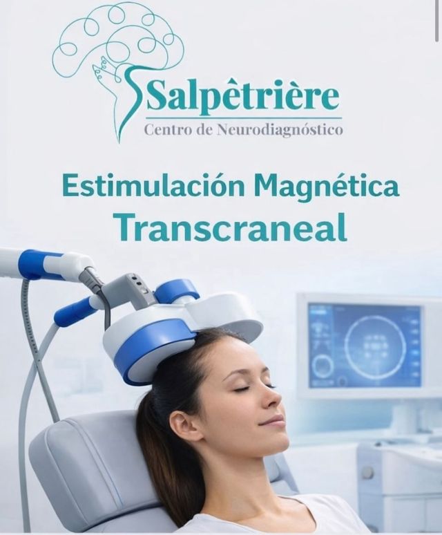 estimulacion magnetica trascraneal